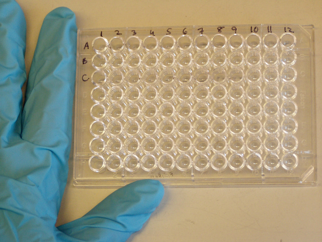 Lyme Disease: The ELISA Test and Ontario Health