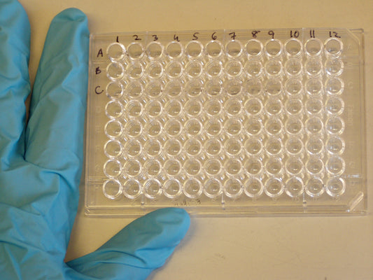 Lyme Disease: The ELISA Test and Ontario Health